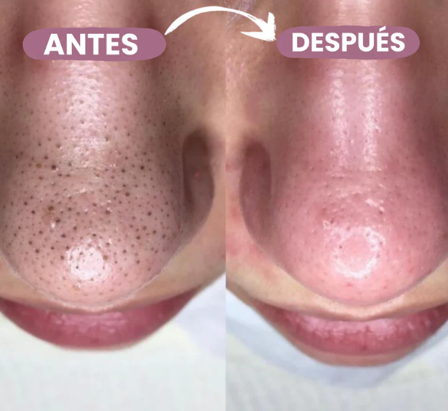 Dúo Exfoliante PeelShot Glow 30Ml